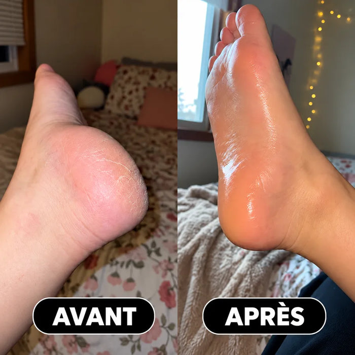 Talons de Isabelle M. avant et après le stick
